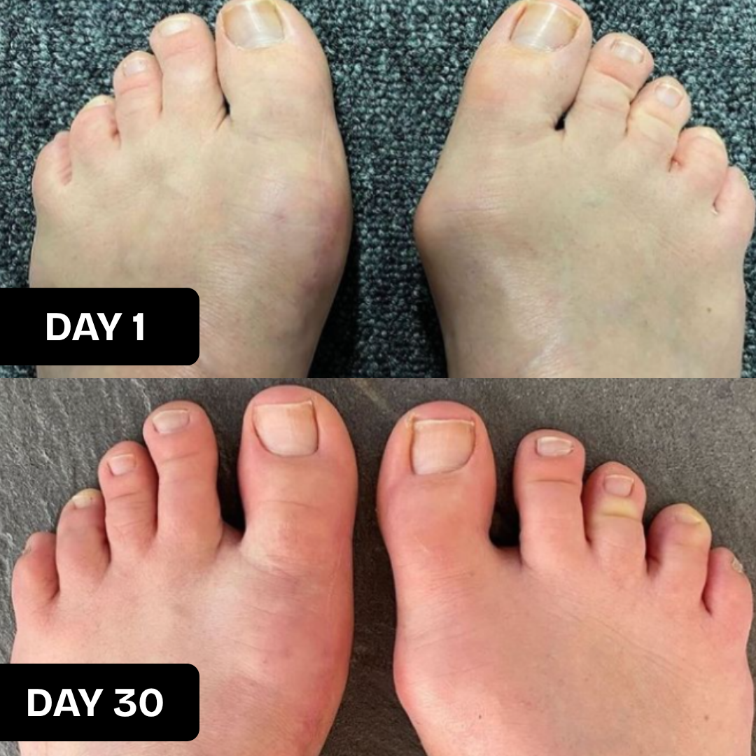 SuperSocks™ - Strength Is The Only True Support